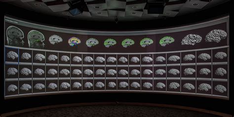 ucla brain mapping center